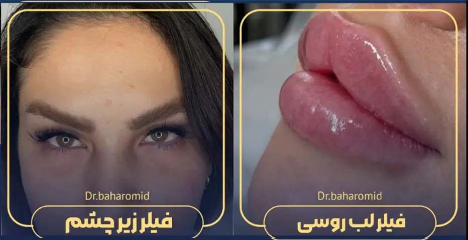 دکتر شیما بهارامید پزشک پوست مو و زیبایی کرج