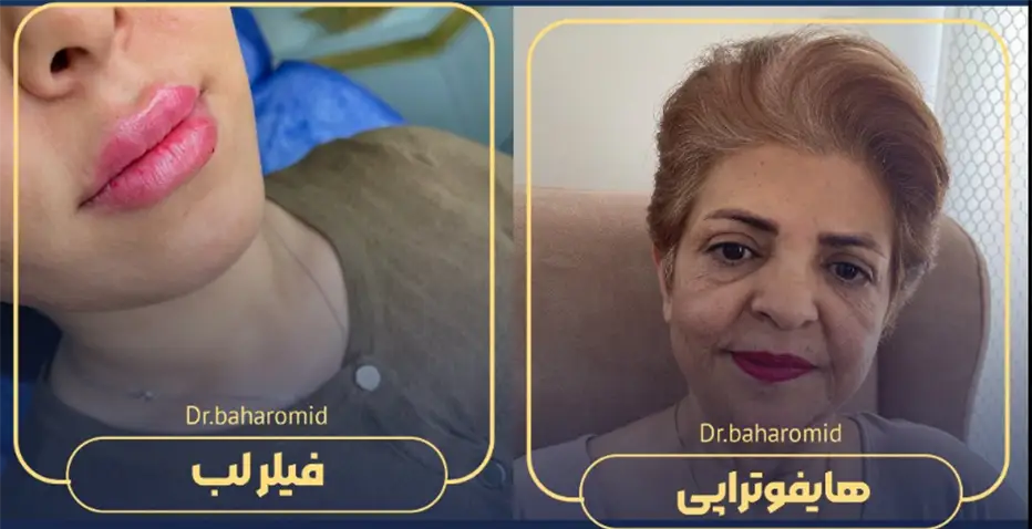 دکتر شیما بهارامید پزشک پوست مو و زیبایی