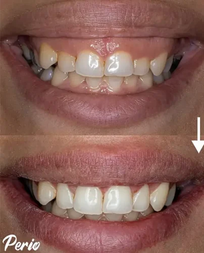 مرکز تخصصی جراحی لثه و ایمپلنت کرج