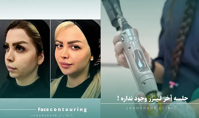 مرکز زیبایی و لیزر جهانشهر کرج