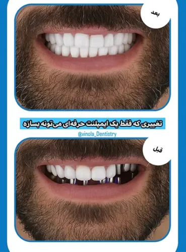 مطب دندانپزشکی وینولا کرج