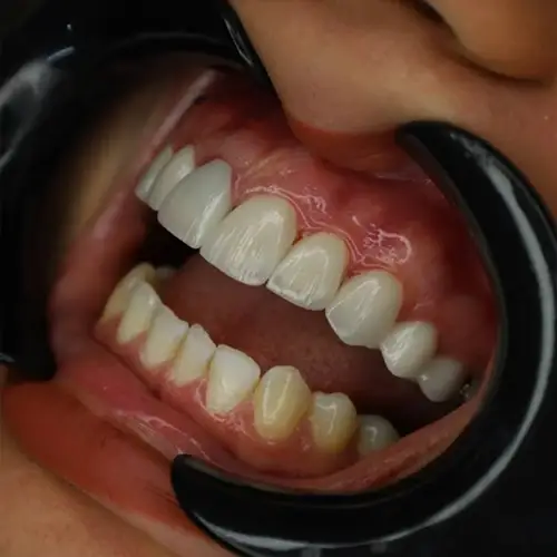 مطب دندانپزشکی وینولا گوهردشت کرج