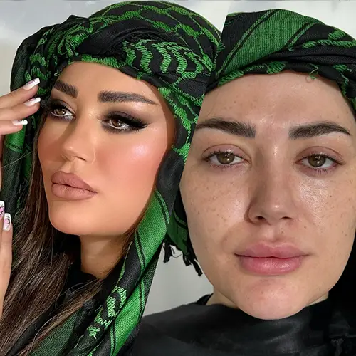 هسنی بیوتی کرج مهرویلا