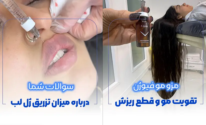 کلینیک زیبایی در کرج تزریق فیلر و مزو تراپی مو