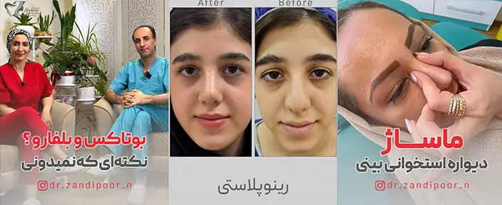 جراحی زیبایی دکتر نجمه زندی