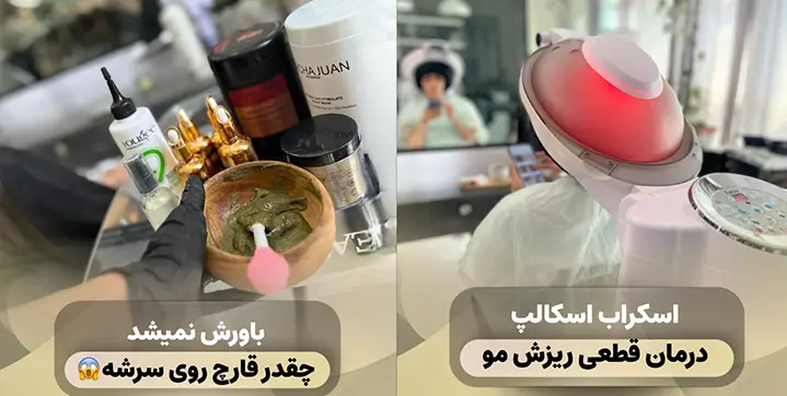مرکز تخصصی اسکراب اسکالپ