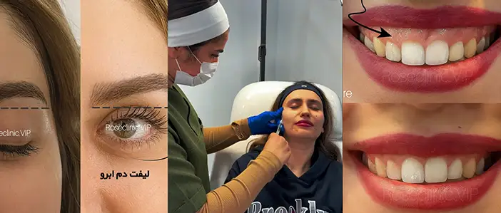کلینیک زیبایی رز
