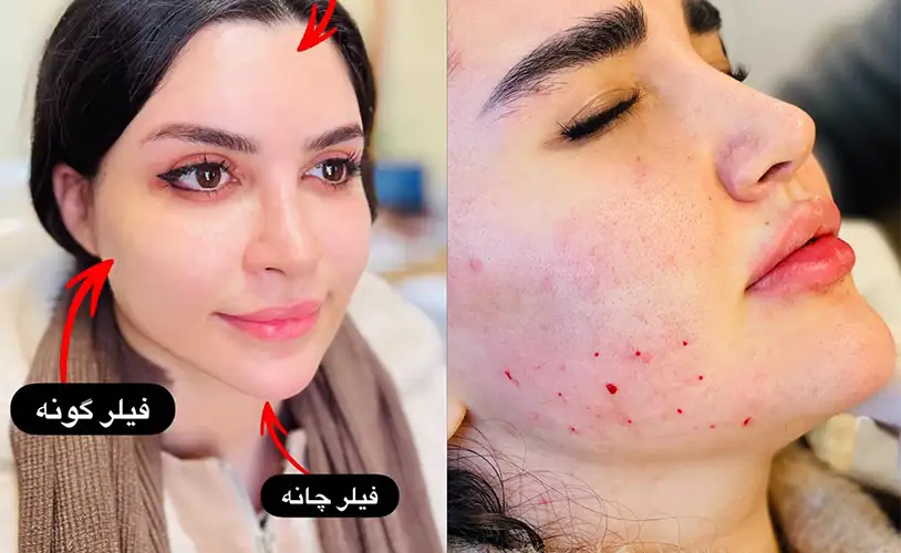 مرکز زیبایی و لیزر لیزا