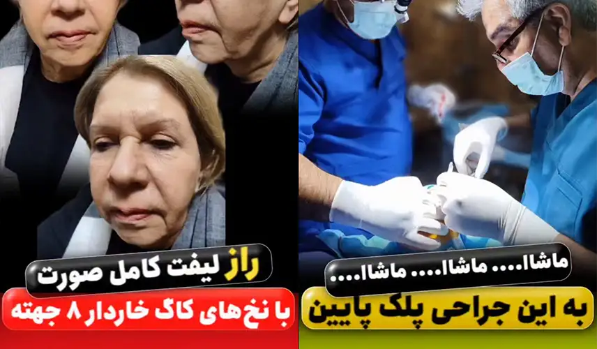 مطب زیبایی دکتر بهرام خسرویانی ، دکتر آتوسا ابوالمعالی