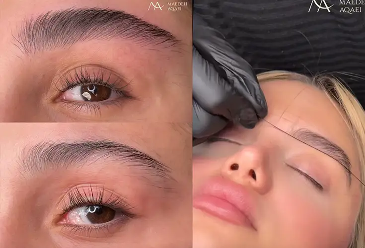 میکروبلیدینگ مائده آقائی
