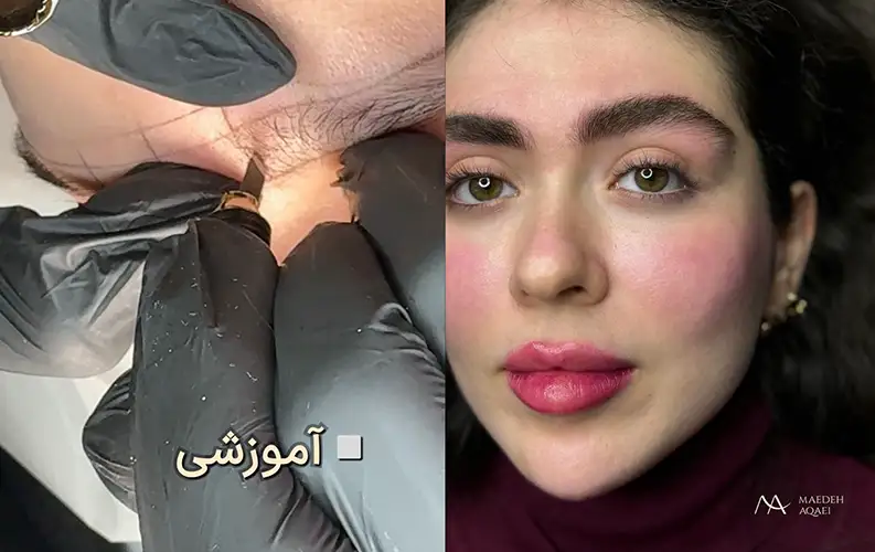 میکروبلیدینگ مائده آقایی مهرشهر