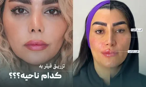 کلینیک زیبایی دکتر فاطمه خاصه تراش