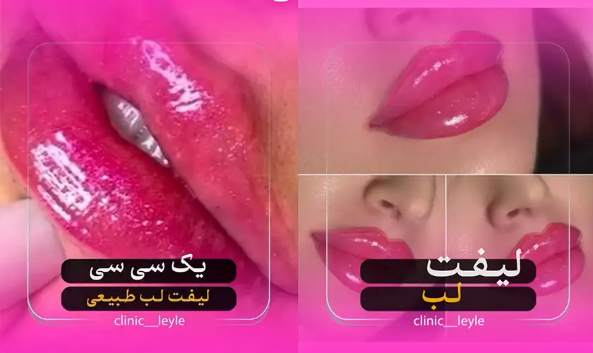 کلینیک زیبایی لیلی