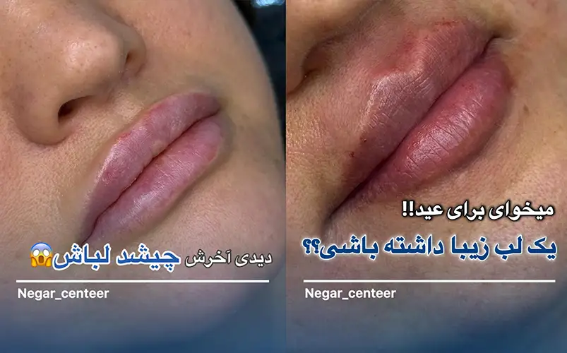 کلینیک زیبایی نگار سنتر