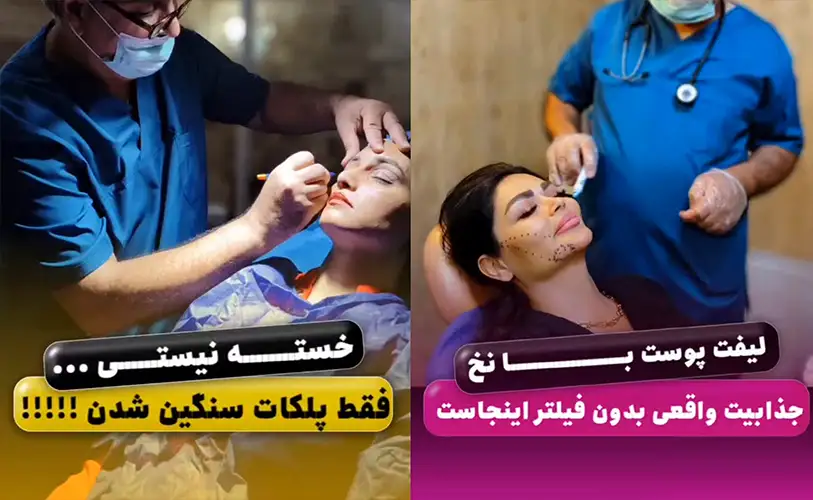 کلینیک زیبایی کرج آتوسا