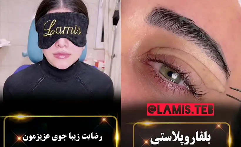 کلینیک لمیس طب کرج آزادگان