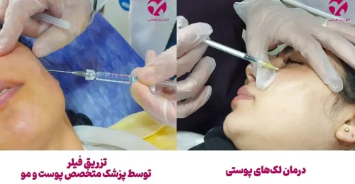 کلینیک پوست و مو بهبد لیرز