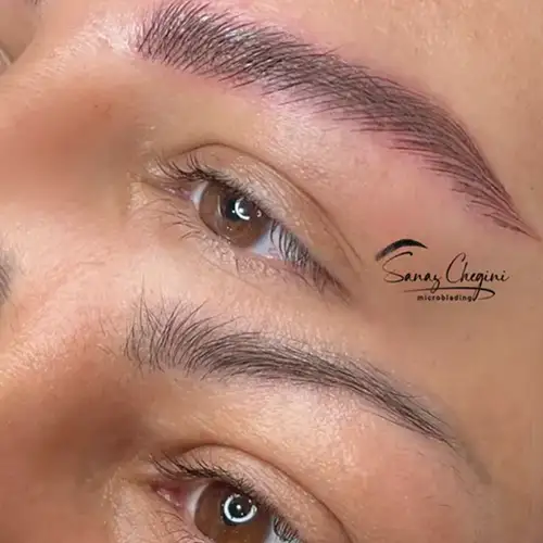 میکروبلیدینگ ساناز چگینی کرج