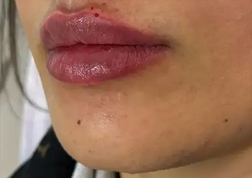 کلینیک زیبایی گلاریس