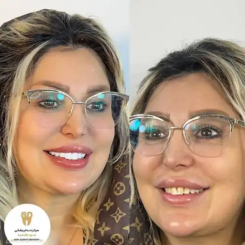 دندانپزشکی سرو کرج عظیمیه