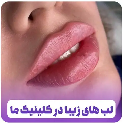 کلینیک زیبایی دکتر مریم مدیر روستا کرج