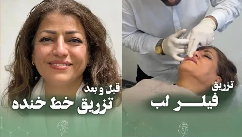 کلینیک زیبایی الینارز