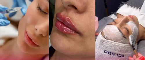 کلینیک زیبایی جودی