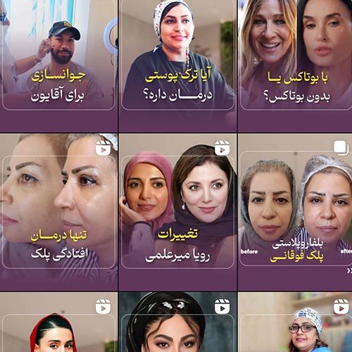 کلینیک دکتر هدیه امین ٬ پوست و مو ٬ لیزر ٬ جراحی پلک