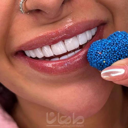 کلینیک دندانپزشکی زیبایی ماهانا در مطهری